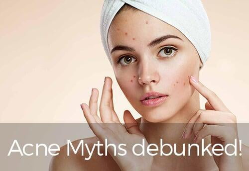 Causes of acne: Truths & Myths